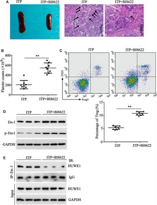 HUWE1 Causes an Immune Imbalance in Immune Thrombocytopenic Purpura by Reducing the Number and Function of Treg Cells Through the Ubiquitination Degradation of Ets-1